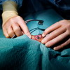 eye_surgery