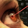 eyes_lazer_2